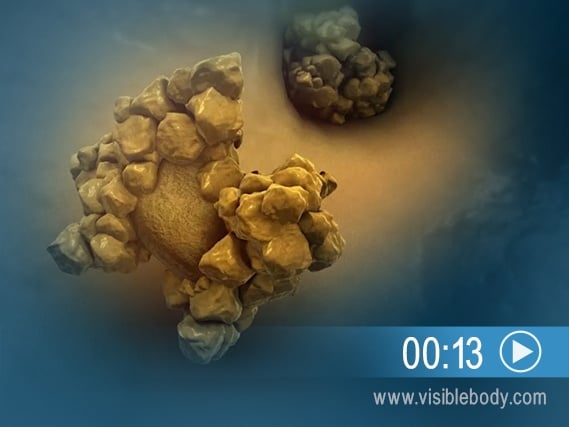 Click to play an animation of kidney stone formation in the urinary tract