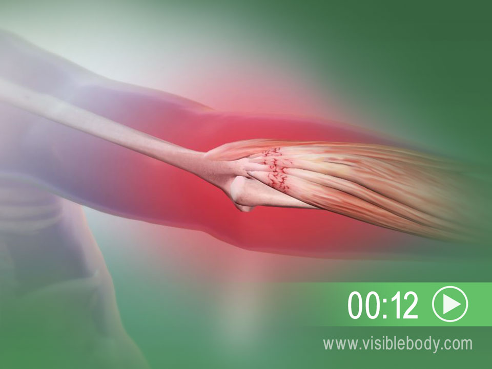 Muscular System Pathologies