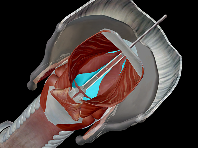 vocalis thyroarytenoid larynx vocal cord