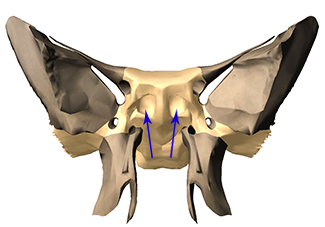 Sphenoid sinuses