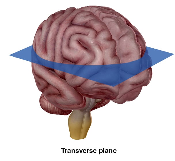 Transverse plane coronal frontal sagittal oblique