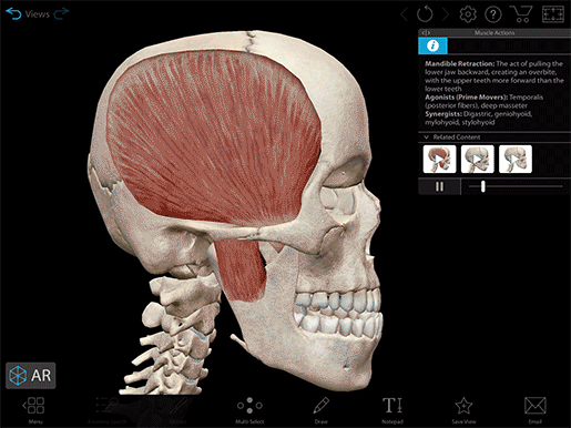 2020-mk-mandible-retraction