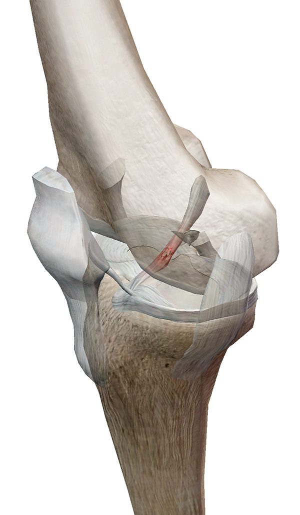 Foot-Pathology-1.png