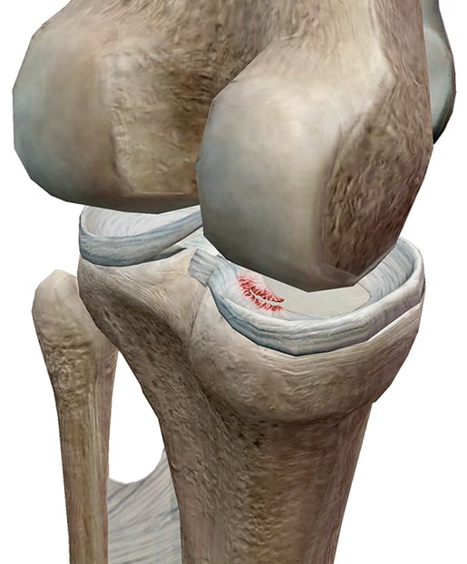 Foot-Pathology-2.png