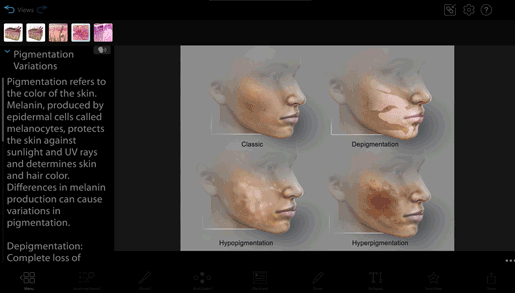 anatomical-variants