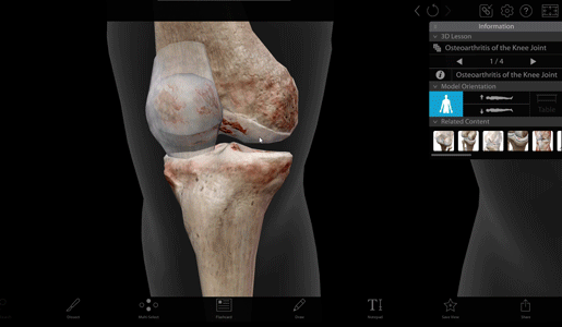 osteoarthritis-model