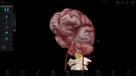 systems-tray-skull-circle-of-willis
