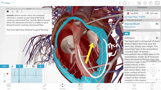 systolic-annotation