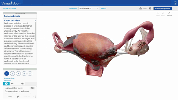Anatomy and Physiology: Homologues of Reproductive Anatomy