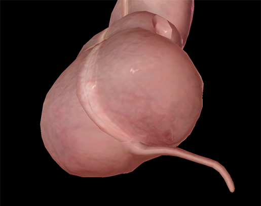 appendix-and-cecum