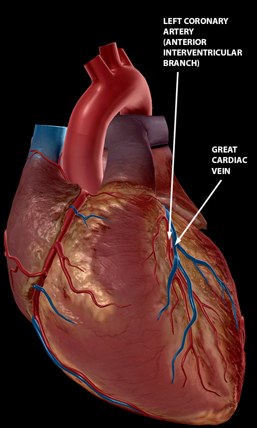 blood-vessels-cardiac-vessels-with-heart-wall