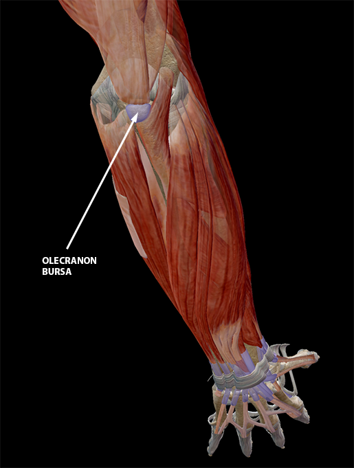 bursitis-elbow-olecranon-bursa-update