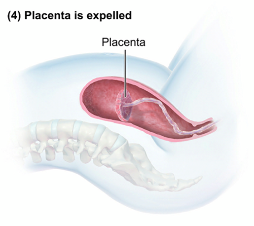 labor-stage-3-placenta-expelled