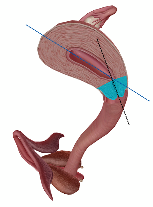 Anatomy & Physiology 4 Facts About the Cervix