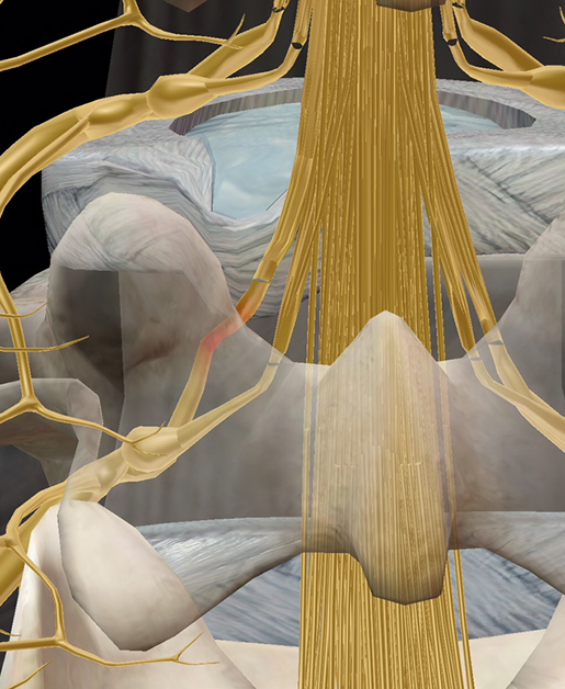 spinal-pathologies-sciatica-pinched-nerve