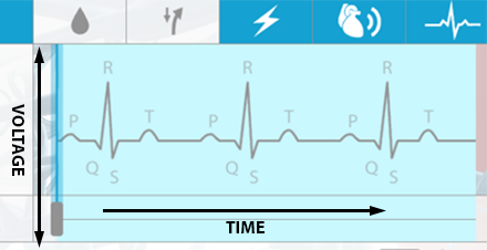 ecg-voltage-over-time