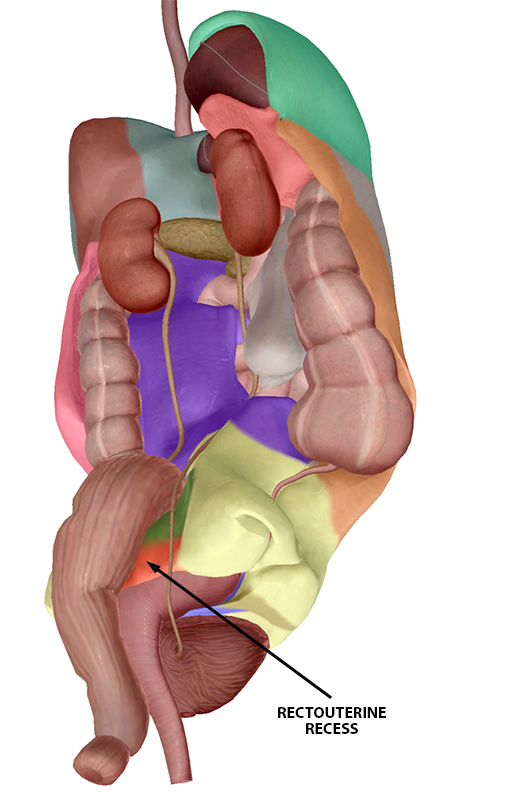peritoneum-landmarks-pelvis-rectouterine-f