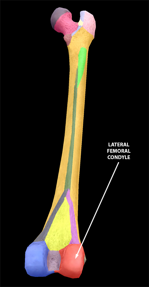 lateral-femoral-condyle
