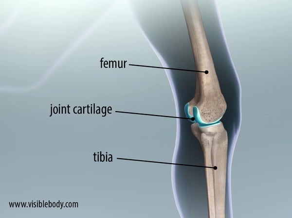 knee joint osteoarthritis.png knee joint osteoarthritis.png