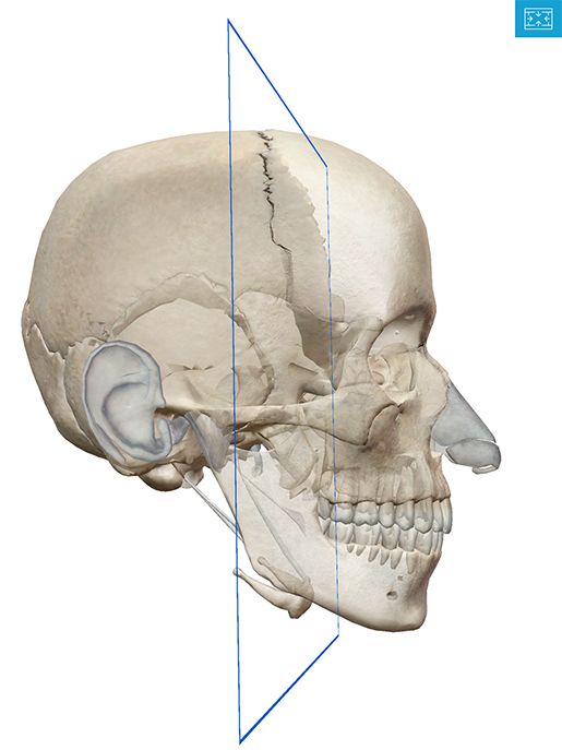 coronal-section-3d