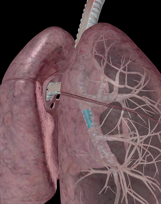 lower-respiratory-lungs-intermediate-secondary-lobar-intrapulmonary-bronchus