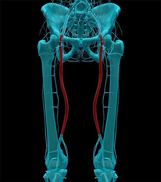 femoral-arteries