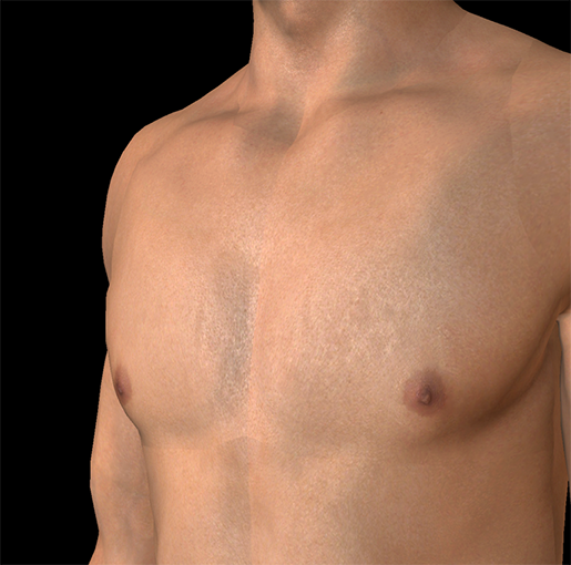 male-breasts-nipples