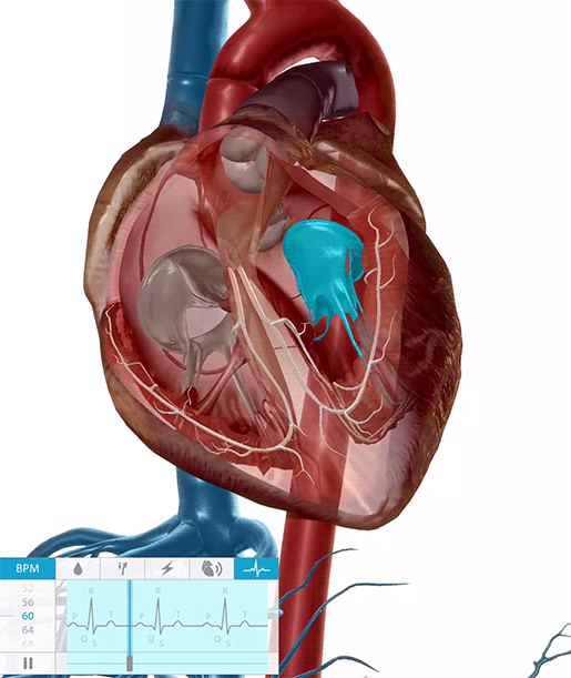 Physiology & Pathology: Four Common Cardiovascular Conditions