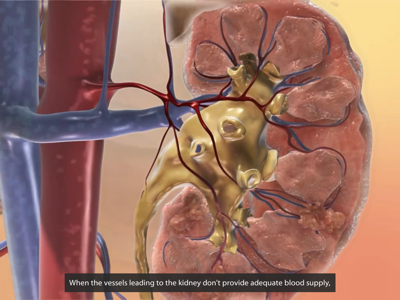 kidney-pathologies-chronic-renal-failure