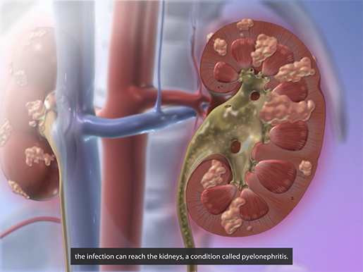 Exploring Kidney Pathologies with Physiology & Pathology