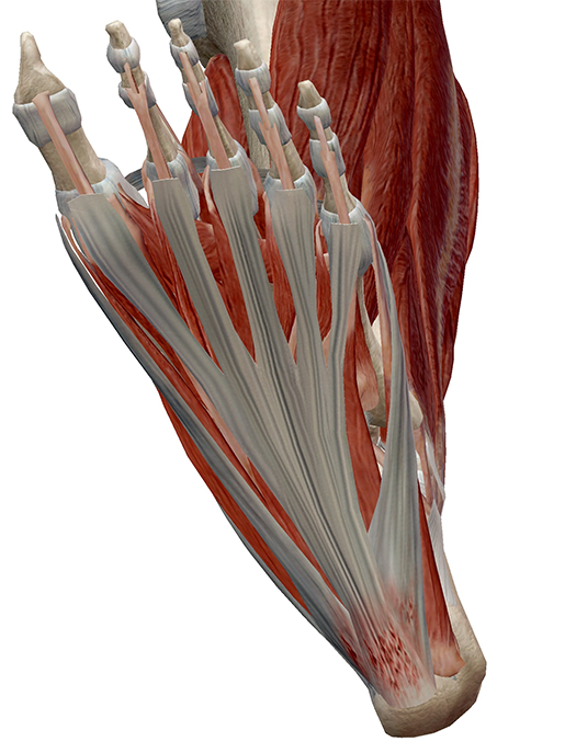 Plantar-aponeurosis-microtears-fasciitis