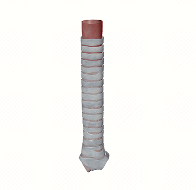 trachea-carina-gif