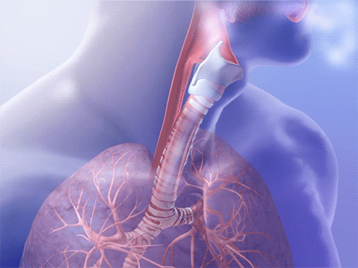 trachea-coughing-trachealis