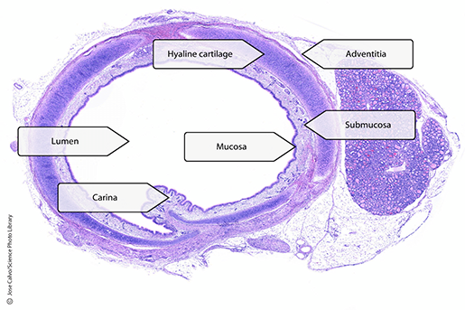 trachea-wall-histology-updated