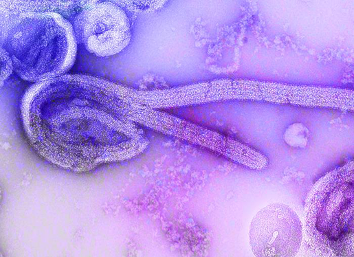 ebola-virus-electron-microscope-1976-cdc