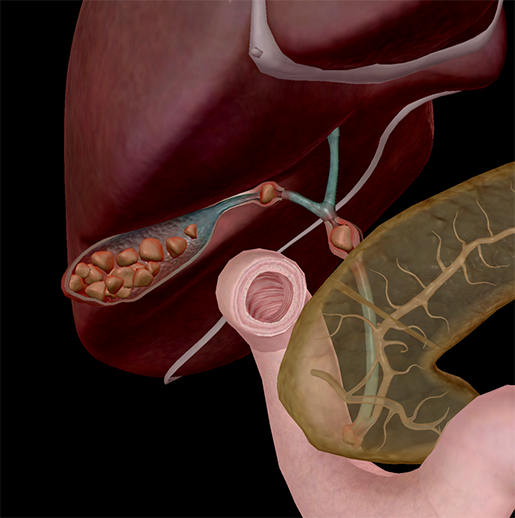 gallstones-physiology-and-pathology-2