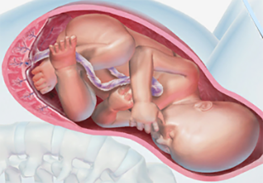 pregnancy-birth