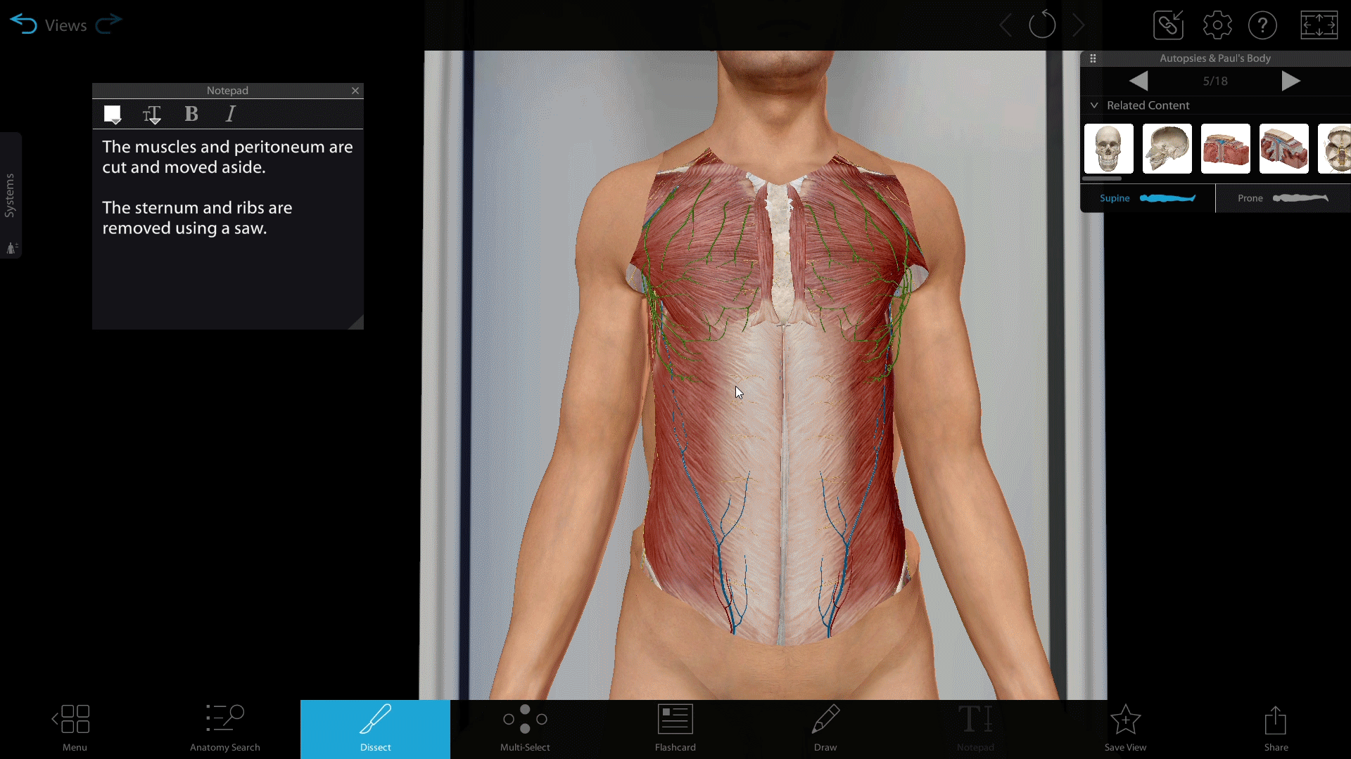 GAL-view-autopsy-dissection-tool