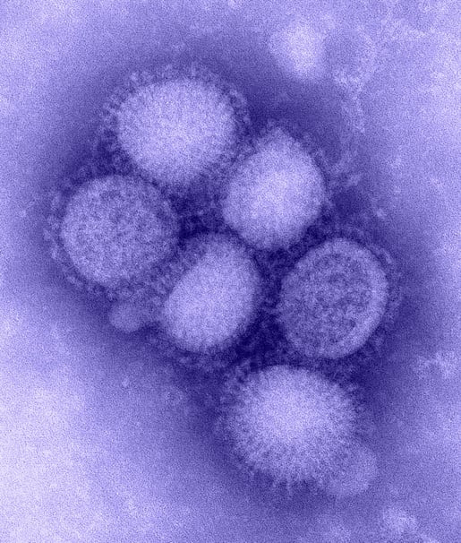 H1N1_influenza_virus (1)