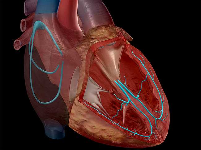 Heart-conduction-system-purkinje-fibers-sinoatrial-node
