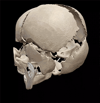 Exploding-Skull