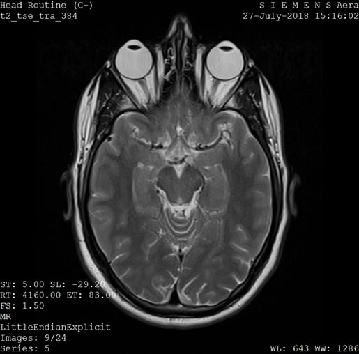 MRI_Scan_General_Illustration