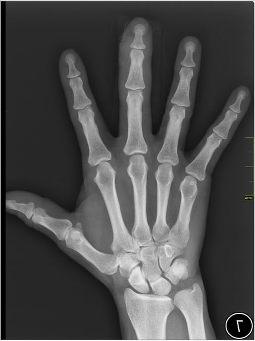 Medical_X-Ray_imaging_JUP05_nevit