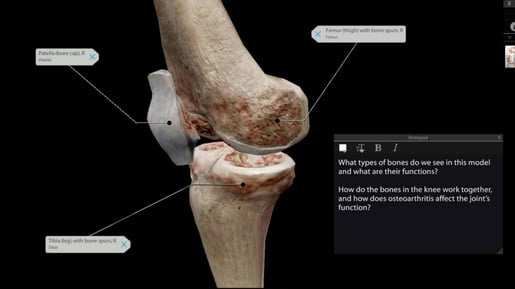osteoarthritis in knee