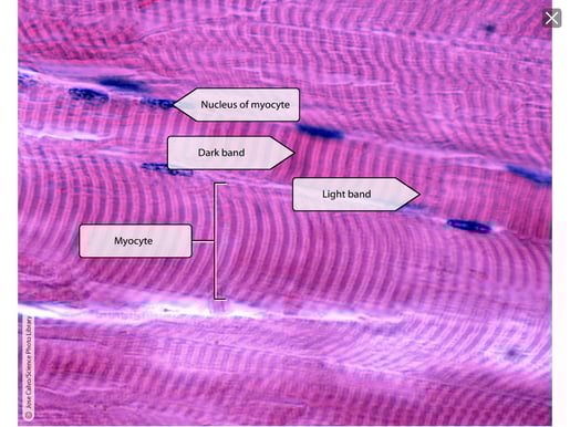 Skeletal Muscle_14.6-3
