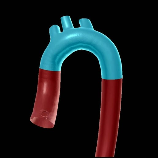 aortic arch