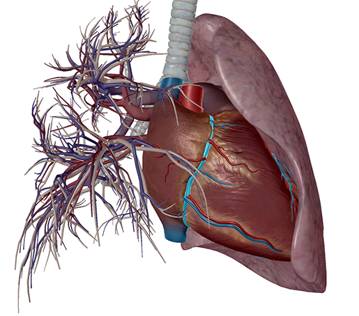 atherosclerosis2