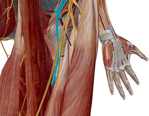 atherosclerosis3