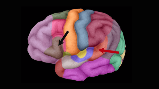 broca and wernickes