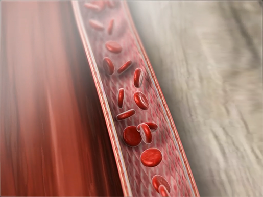 cholesteral